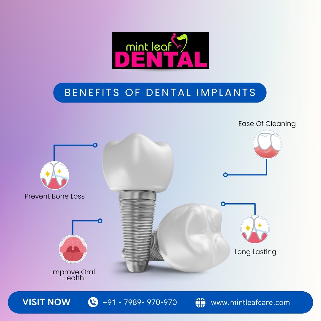 Life Changing Benefits of Dental Implants.