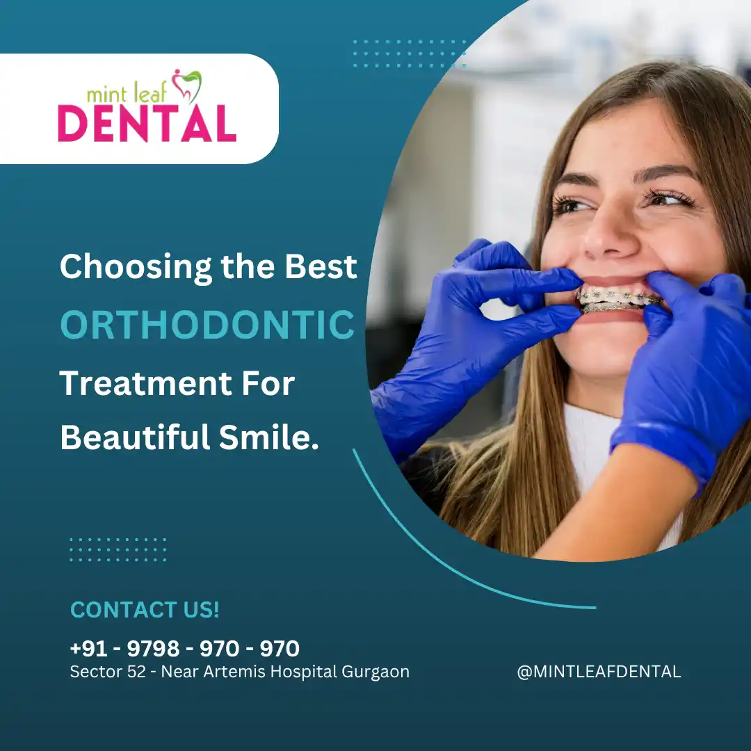 Orthodontics Treatment in Sector 52, Gurgaon Near Artemis Hospital