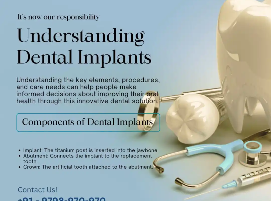 Understanding Dental Implants
