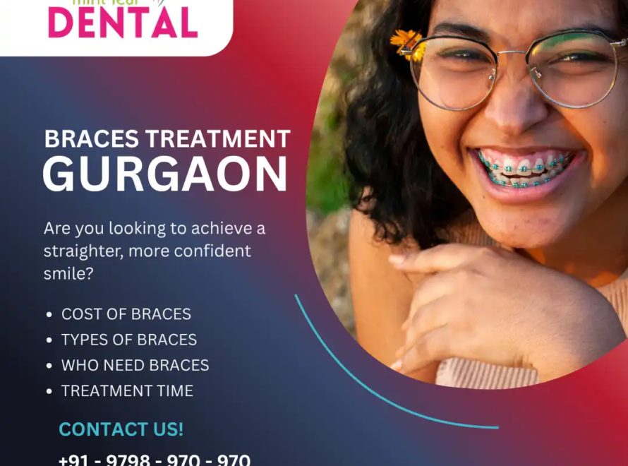 Braces Treatment in Gurgaon