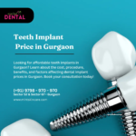 Teeth Implant Price In Gurgaon