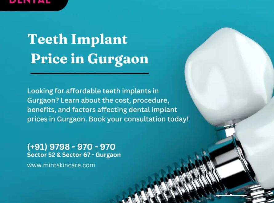 Teeth Implant Price In Gurgaon