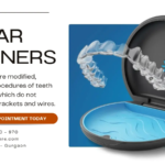 Clear Aligners in Sector 52 Gurgaon