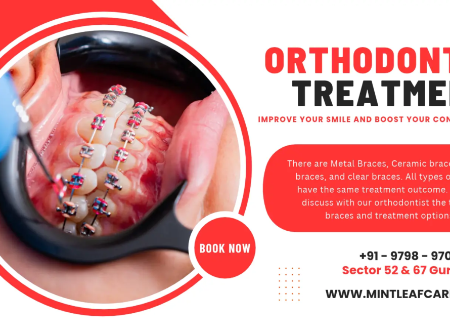 Teeth Braces Cost in Gurgaon?