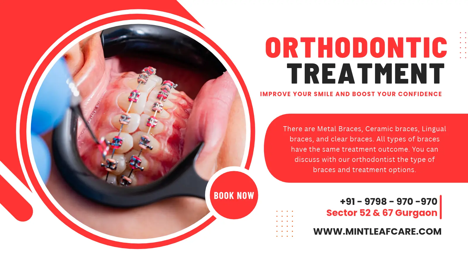 Teeth Braces Cost in Gurgaon?