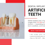 Dental Implant Cost in Gurgaon