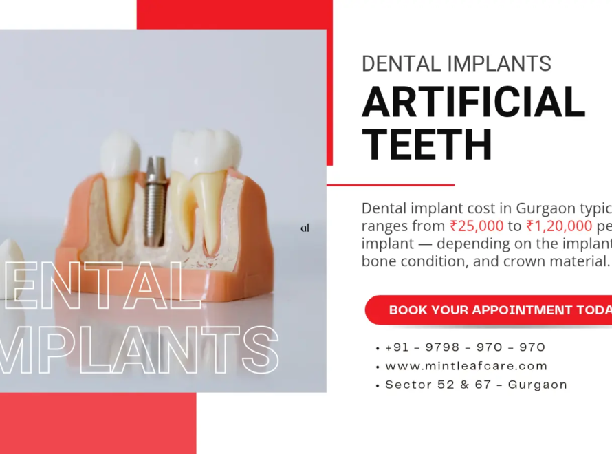 Dental Implant Cost in Gurgaon
