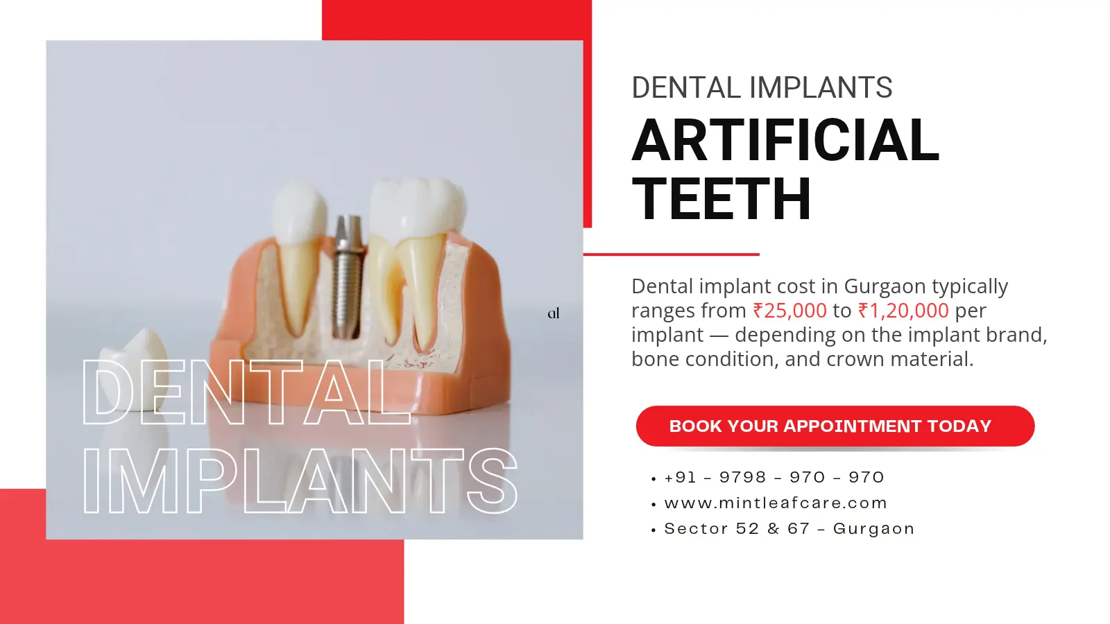 Dental Implant Cost in Gurgaon