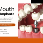Full Mouth Implants in Gurgaon